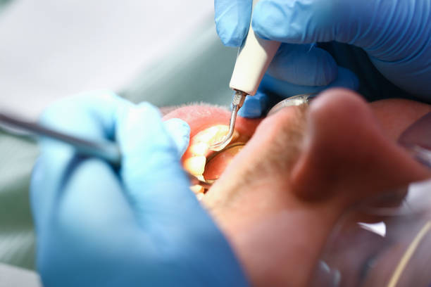 Best Emergency Dental Care for Broken or Chipped Teeth in Little Round Lake, WI