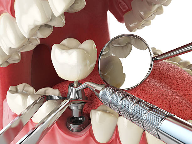 Best Urgent Care for Lost Fillings or Crowns in Little Round Lake, WI